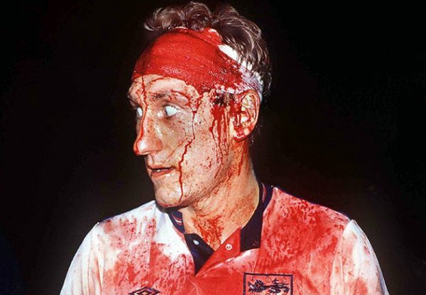 Terry Butcher bloody